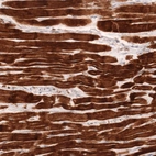 Immunohistochemical staining of human heart muscle shows strong cytoplasmic positivity in cardiomyocytes.