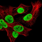 Immunofluorescent staining of human cell line Hep G2 shows localization to nucleoplasm.
