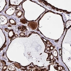 Anti-OSBPL5 Antibody