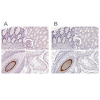 Anti-KRT82 Antibody