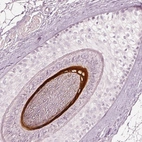 Immunohistochemical staining of human skin shows strong cytoplasmic positivity in hair follicle.