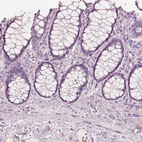 Anti-KRT82 Antibody