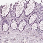 Immunohistochemical staining of human colon shows no positivity in glandular cells as expected.