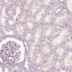 Immunohistochemical staining of human kidney shows no positivity in cells in tubules as expected.