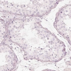 Immunohistochemical staining of human testis shows no positivity in cells in seminiferous ducts as expected.