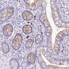 Anti-C12orf71 Antibody