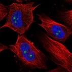 Anti-RBM19 Antibody