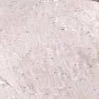 Immunohistochemical staining of human skeletal muscle shows negative to very weak cytoplasmic positivity in myocytes.