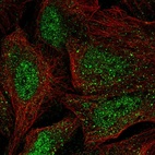 Anti-WBP4 Antibody