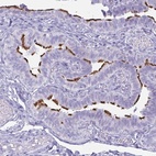 Anti-BBS10 Antibody