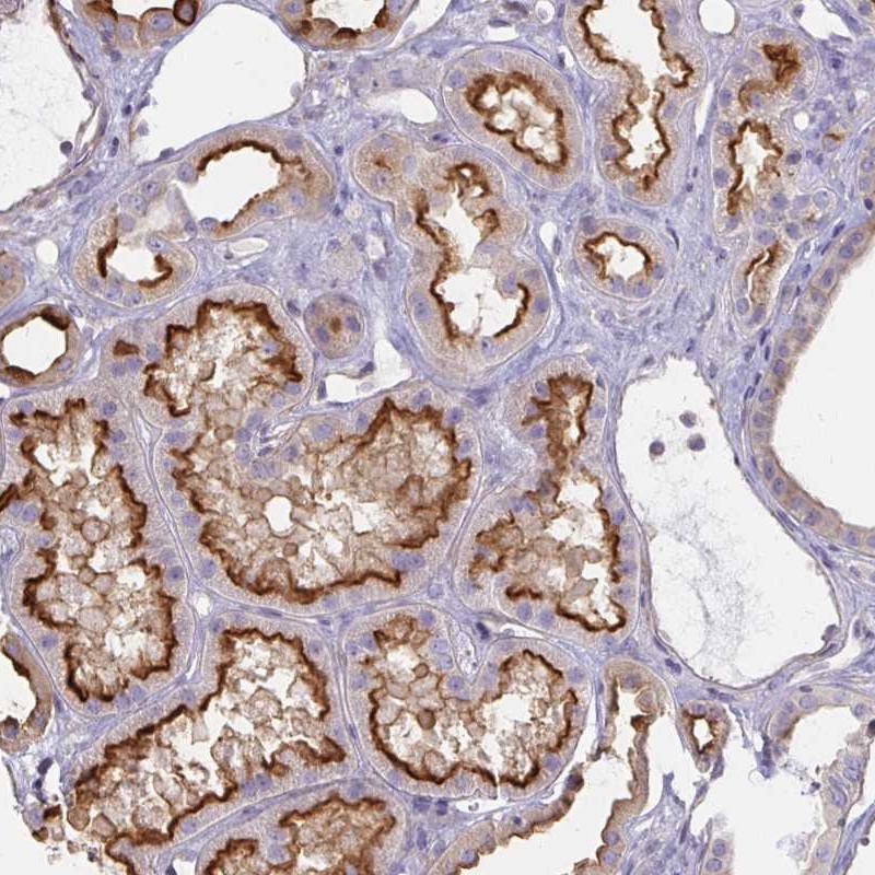 Anti-ANKRD33 Antibody