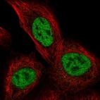 Anti-TSSC4 Antibody