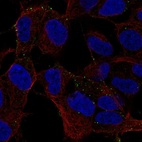 Anti-MYO16 Antibody