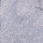 Immunohistochemical staining of human tonsil shows no positivity in non-germinal center cells as expected.
