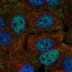 Anti-FAM222A Antibody