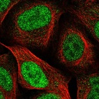Immunofluorescent staining of human cell line U-2 OS shows localization to nucleoplasm.