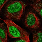 Immunofluorescent staining of human cell line U-2 OS shows localization to nucleoplasm.