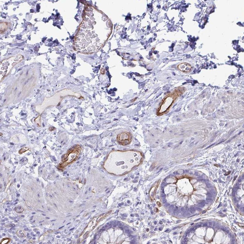 Anti-UBL3 Antibody