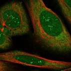 Anti-RBMS2 Antibody