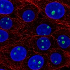 Immunofluorescent staining of human cell line MCF7 shows localization to nucleoli.
