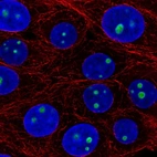 Immunofluorescent staining of human cell line MCF7 shows localization to nucleoli.