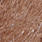 Anti-CCDC168 Antibody