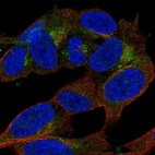 Anti-APBA2 Antibody