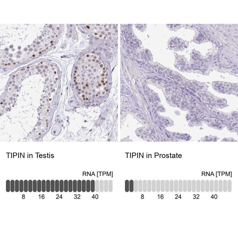 Anti-TIPIN Antibody
