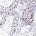 Immunohistochemical staining of human testis shows high expression.