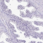 Immunohistochemical staining of human prostate shows low expression as expected.