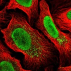 Anti-MYCBP2 Antibody