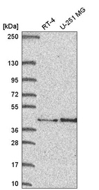 Anti-FAM107B Antibody