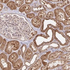 Anti-AACS Antibody