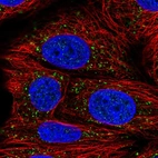 Immunofluorescent staining of human cell line MCF7 shows localization to vesicles.