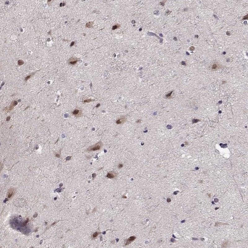 Anti-TESPA1 Antibody