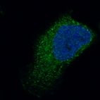 Immunofluorescence staining in RH-30 cell line with Anti-TNNT2 monoclonal antibody, showing specific staining of cytosol in green. Microtubule- and nuclear probes are visualized in red and blue respectively (where available).