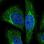 Immunofluorescent staining of human cell line SiHa shows localization to cytosol.