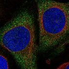 Anti-PGGHG Antibody