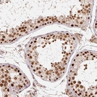 Immunohistochemical staining of human testis shows strong nuclear positivity in cells in seminiferous ducts.