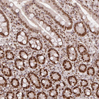 Anti-POLD3 Antibody