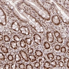 Immunohistochemical staining of human duodenum shows strong nuclear positivity in glandular cells.
