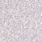 Anti-POLD3 Antibody