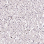 Immunohistochemical staining of human liver shows no positivity in hepatocytes as expected.