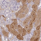 Anti-ANO5 Antibody