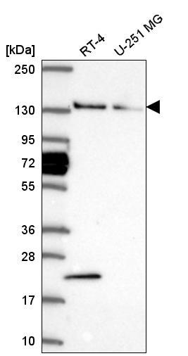 Anti-WDR19 Antibody