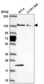 Anti-WDR19 Antibody