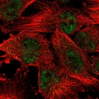 Immunofluorescent staining of human cell line U-251 MG shows localization to nucleoplasm.