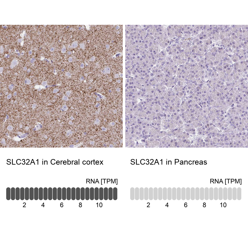 Anti-SLC32A1 Antibody