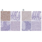 Immunohistochemical staining of human cerebral cortex, colon, lymph node and pancreas using Anti-VGAT antibody HPA058859 (A) shows similar protein distribution across tissues to independent antibody HPA059985 (B).