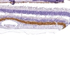 Immunohistochemical staining of human eye, retina shows strong cytoplasmic positivity in Inner plexiform layer.